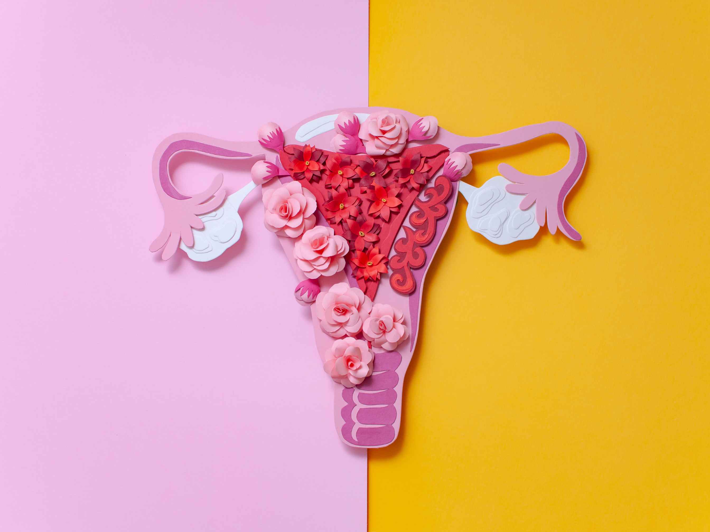 Endometriosis: Understand Pain, the Impact, &amp; the Path to Relief